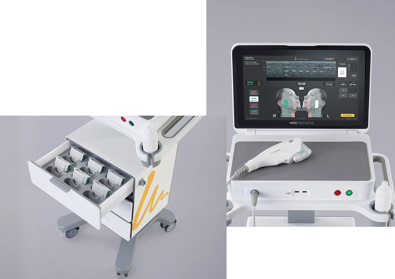 Two-part image showing Ultherapy<sup>&reg;</sup> device drawer with transducers and top portion with control unit and handpiece.