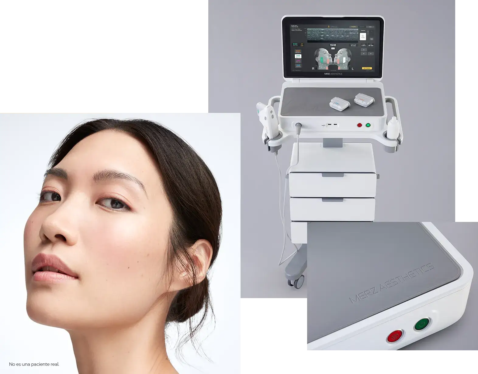 UCollage of a woman’s face, the full Ultherapy PRIME<sup>&reg;</sup> device, and a close-up of its buttons.