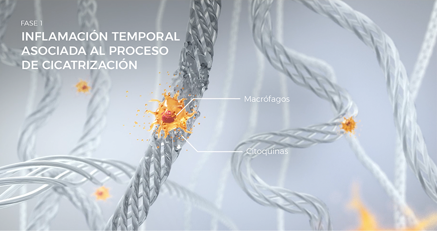 Visualización de los macrófagos durante la Fase 1 de cicatrización, mostrando la inflamación temporal y la reparación de tejido.