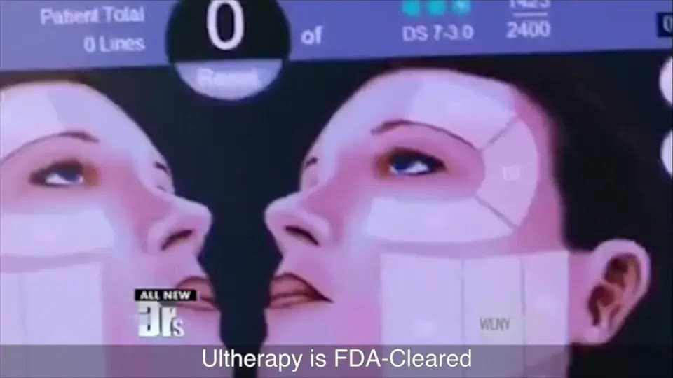 Ultherapy in the news: The Doctors
